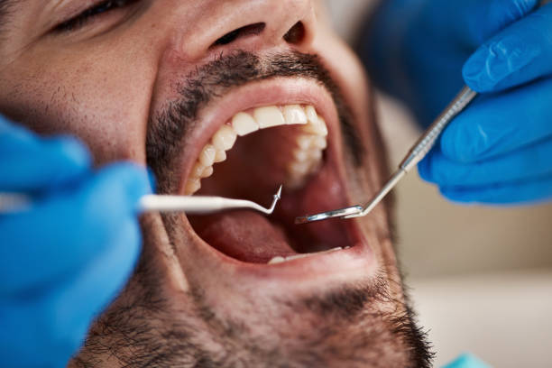 Best Emergency Gum Pain Relief  in Belleair Bluffs, FL